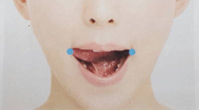 舌の横伸ばし